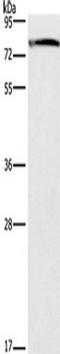 Galactosylceramidase antibody, TA351208, Origene, Western Blot image 