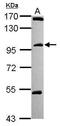 Coiled-Coil Domain Containing 178 antibody, GTX119924, GeneTex, Western Blot image 