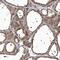 Erythrocyte Membrane Protein Band 4.1 Like 4A antibody, PA5-57728, Invitrogen Antibodies, Immunohistochemistry frozen image 