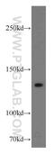 Large adhesive scatter factor 140 kDa subunit antibody, 19698-1-AP, Proteintech Group, Western Blot image 
