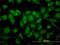 Mitogen-activated protein kinase 12 antibody, H00006300-M05, Novus Biologicals, Immunocytochemistry image 
