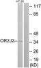 Olfactory Receptor Family 2 Subfamily J Member 2 antibody, GTX87957, GeneTex, Western Blot image 