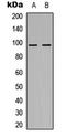 Nucleolar Protein With MIF4G Domain 1 antibody, LS-C356219, Lifespan Biosciences, Western Blot image 