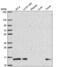 Phosphatidylinositol-5-Phosphate 4-Kinase Type 2 Gamma antibody, NBP2-56140, Novus Biologicals, Western Blot image 