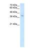 MHC Class I Polypeptide-Related Sequence A antibody, NBP1-59185, Novus Biologicals, Western Blot image 