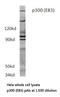 E1A Binding Protein P300 antibody, LS-C176437, Lifespan Biosciences, Western Blot image 