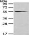 UDP Glucuronosyltransferase Family 1 Member A4 antibody, orb525332, Biorbyt, Western Blot image 
