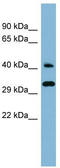 DnaJ Heat Shock Protein Family (Hsp40) Member C27 antibody, TA345012, Origene, Western Blot image 