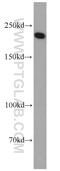 Slit homolog 2 protein antibody, 20217-1-AP, Proteintech Group, Western Blot image 
