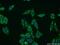 Collagen Type VIII Alpha 1 Chain antibody, 17251-1-AP, Proteintech Group, Immunofluorescence image 