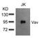 Vav Guanine Nucleotide Exchange Factor 1 antibody, 79-563, ProSci, Western Blot image 