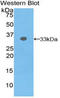 Integrin Subunit Beta 2 antibody, LS-C294700, Lifespan Biosciences, Western Blot image 