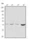 Pim-1 Proto-Oncogene, Serine/Threonine Kinase antibody, PB9315, Boster Biological Technology, Western Blot image 