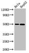 Phosphatidylcholine:ceramide cholinephosphotransferase 1 antibody, orb401060, Biorbyt, Western Blot image 