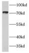 Guanylate Cyclase 1 Soluble Subunit Beta 1 antibody, FNab03727, FineTest, Western Blot image 