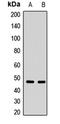 Neuronal pentraxin-2 antibody, LS-C667934, Lifespan Biosciences, Western Blot image 