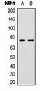 Tumor Protein P63 antibody, LS-C358372, Lifespan Biosciences, Western Blot image 