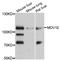 Mov10 RISC Complex RNA Helicase antibody, STJ24600, St John