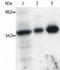 FYN Proto-Oncogene, Src Family Tyrosine Kinase antibody, SM3108P, Origene, Western Blot image 