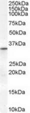 Voltage-dependent anion-selective channel protein 2 antibody, TA302698, Origene, Western Blot image 