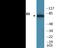 Arachidonate 5-Lipoxygenase antibody, EKC2187, Boster Biological Technology, Western Blot image 