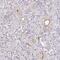 DENN Domain Containing 5A antibody, NBP2-30981, Novus Biologicals, Immunohistochemistry paraffin image 