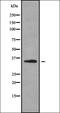 Adhesion G Protein-Coupled Receptor B3 antibody, orb336386, Biorbyt, Western Blot image 