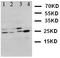 BCL10 Immune Signaling Adaptor antibody, LS-C312664, Lifespan Biosciences, Western Blot image 
