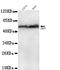 Akt antibody, LS-C178305, Lifespan Biosciences, Western Blot image 