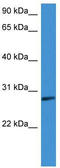 Complement Factor D antibody, TA342870, Origene, Western Blot image 