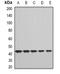 Complement Factor H Related 3 antibody, orb341353, Biorbyt, Western Blot image 