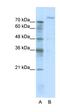 Zinc Fingers And Homeoboxes 2 antibody, orb330042, Biorbyt, Western Blot image 