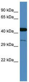 COP9 Signalosome Subunit 3 antibody, TA342585, Origene, Western Blot image 