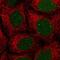Non-Homologous End Joining Factor 1 antibody, NBP2-55106, Novus Biologicals, Immunocytochemistry image 