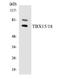 T-Box 18 antibody, EKC1664, Boster Biological Technology, Western Blot image 