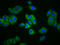 Electrogenic sodium bicarbonate cotransporter 4 antibody, LS-C681377, Lifespan Biosciences, Immunofluorescence image 