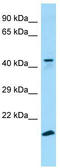 Probable G-protein coupled receptor 34 antibody, TA338154, Origene, Western Blot image 