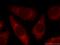 Keratin 23 antibody, 24049-1-AP, Proteintech Group, Immunofluorescence image 