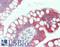 Microsomal Triglyceride Transfer Protein antibody, LS-B15679, Lifespan Biosciences, Immunohistochemistry paraffin image 