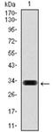 Hyaluronan synthase 3 antibody, AM06752PU-N, Origene, Western Blot image 