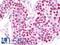 RAN Binding Protein 6 antibody, LS-B9881, Lifespan Biosciences, Immunohistochemistry paraffin image 