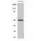 Interleukin 13 Receptor Subunit Alpha 1 antibody, LS-C384087, Lifespan Biosciences, Western Blot image 