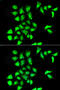 Methionine-R-sulfoxide reductase B1 antibody, MBS129830, MyBioSource, Immunofluorescence image 