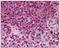 CD267 antibody, AP08485PU-N, Origene, Immunohistochemistry paraffin image 