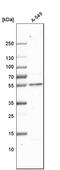 Glucosaminyl (N-Acetyl) Transferase 3, Mucin Type antibody, HPA011154, Atlas Antibodies, Western Blot image 
