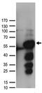 Aldehyde Dehydrogenase 9 Family Member A1 antibody, TA890045, Origene, Western Blot image 