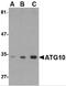 Ubiquitin-like-conjugating enzyme ATG10 antibody, 4399, ProSci, Western Blot image 