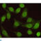 SMAD2 antibody, LS-C813117, Lifespan Biosciences, Immunocytochemistry image 