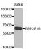 Protein Phosphatase 2 Scaffold Subunit Abeta antibody, A6703, ABclonal Technology, Western Blot image 