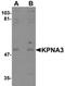 Karyopherin Subunit Alpha 3 antibody, orb75499, Biorbyt, Western Blot image 